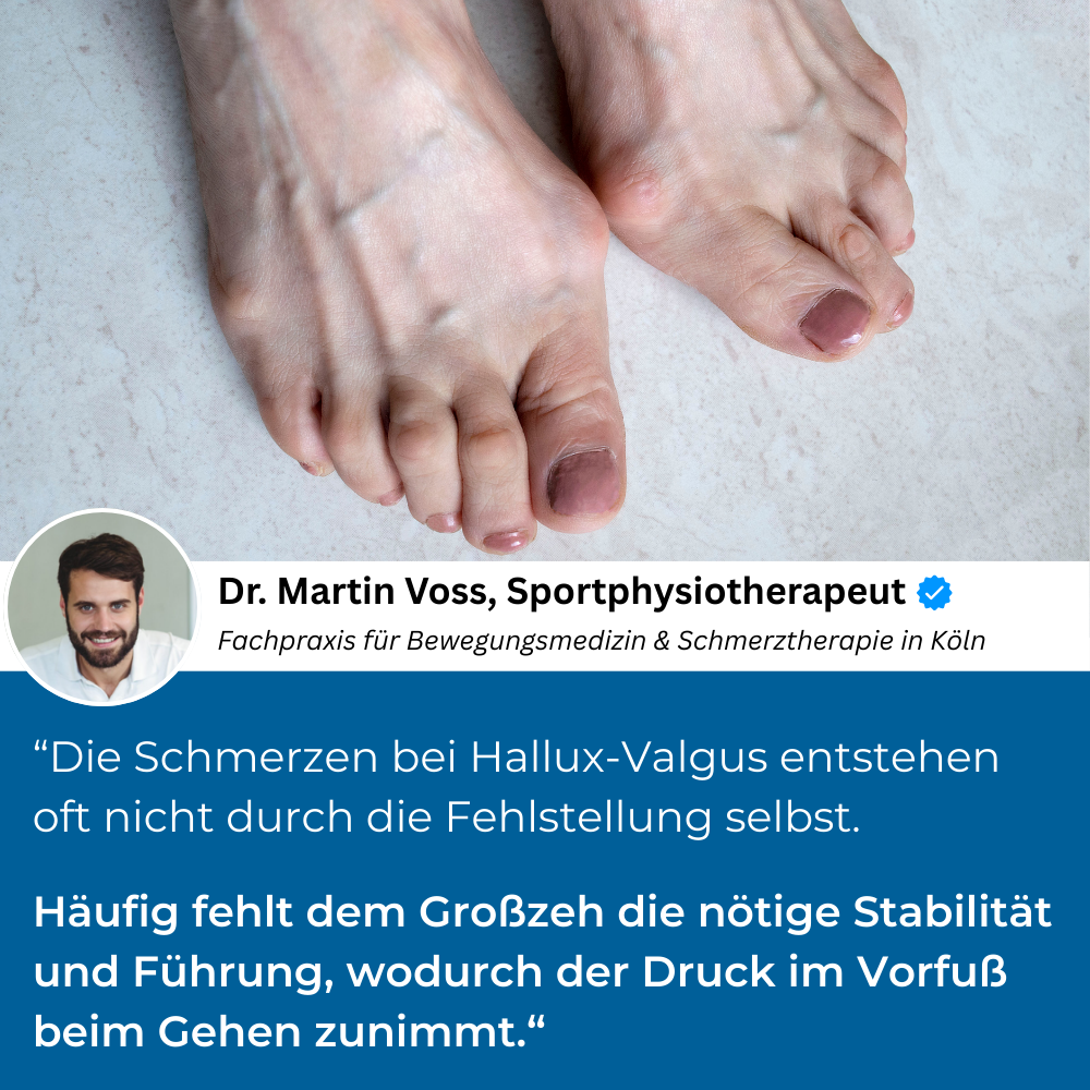 TAPEX™ - Hallux-Valgus