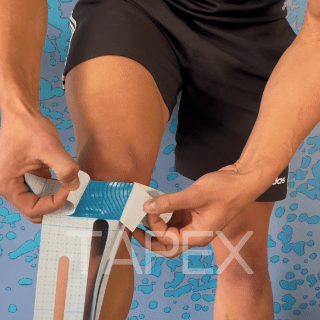 TAPEX™ - Kniegelenk