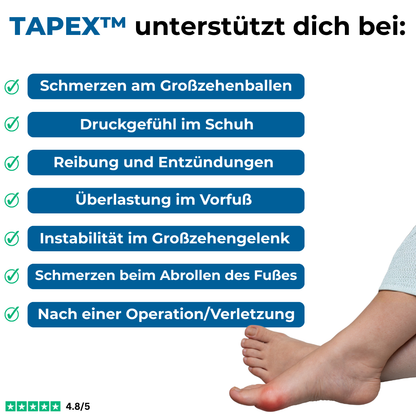 TAPEX™ - Hallux-Valgus
